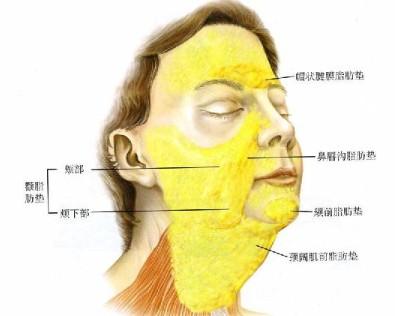 面部吸脂瘦脸的效果怎么样__寻医问药_xywy.c